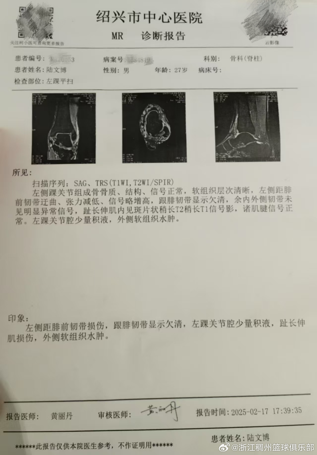 仅局限于国